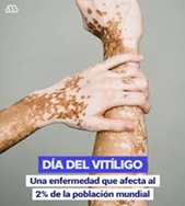 Día mundila del Vitíligo